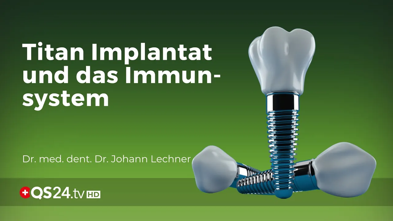Titan Zahnimplantat und Immunreaktion | Dr. med. dent. Dr. Johann Lechner | NaturMEDIZIN | QS24