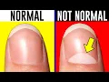 10 Signs You're Actually Normal.. Mp3 Song Download