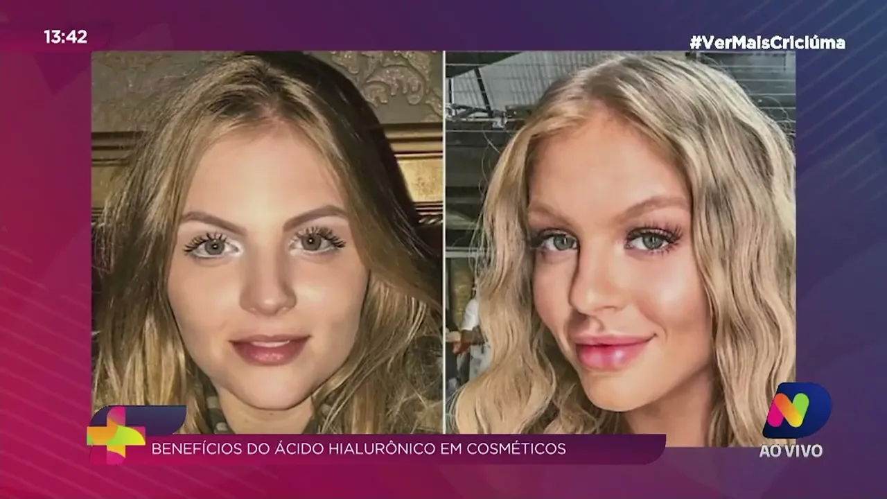 Ver Mais Transformação: conheça os benefícios do ácido hialurônico em cosméticos
