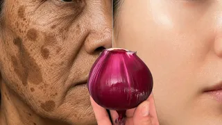 🌱Eine Pflanze, die alles heilt❗️Gesicht wie neu! Stoppen Sie Falten