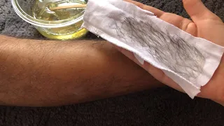 أسهل طريقة لتحضير الحلاوة او السويت لازالة الشعرمن جميع مناطق الجسم بدون ألم 