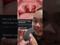 Download Lagu BENGKAK TONSIL SEMBUH DENGAN AISKRIM VANILA?