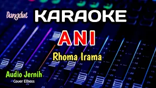 Download ANI - RHOMA IRAMA - KARAOKE - COVER ELBASS MP3