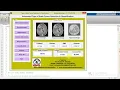 Brain Tumor Types Detection and Classification using Matlab Project Code