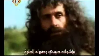     جراح حبيبى   كورال           دندنها