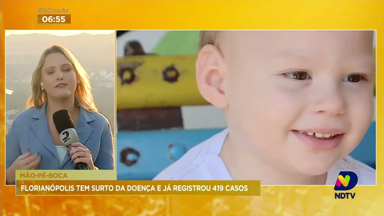 Casos de mão-pé-boca preocupam as autoridades em Florianópolis