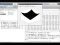 Stability Region of Implicit Methods Backward Euler