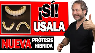 ✅NUEVA Prótesis 𝗛𝗜𝗕𝗥𝗜𝗗𝗔𝗦 𝘀𝗼𝗯𝗿𝗲 𝗜𝗠𝗣𝗟𝗔𝗡𝗧𝗘𝗦  Ventajas y Desventajas. Prótesis Dental Fija SI RECOMIENDO