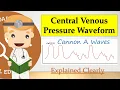 Central Venous Pressure CVP Waveform and Tracing - Cannon A Waves