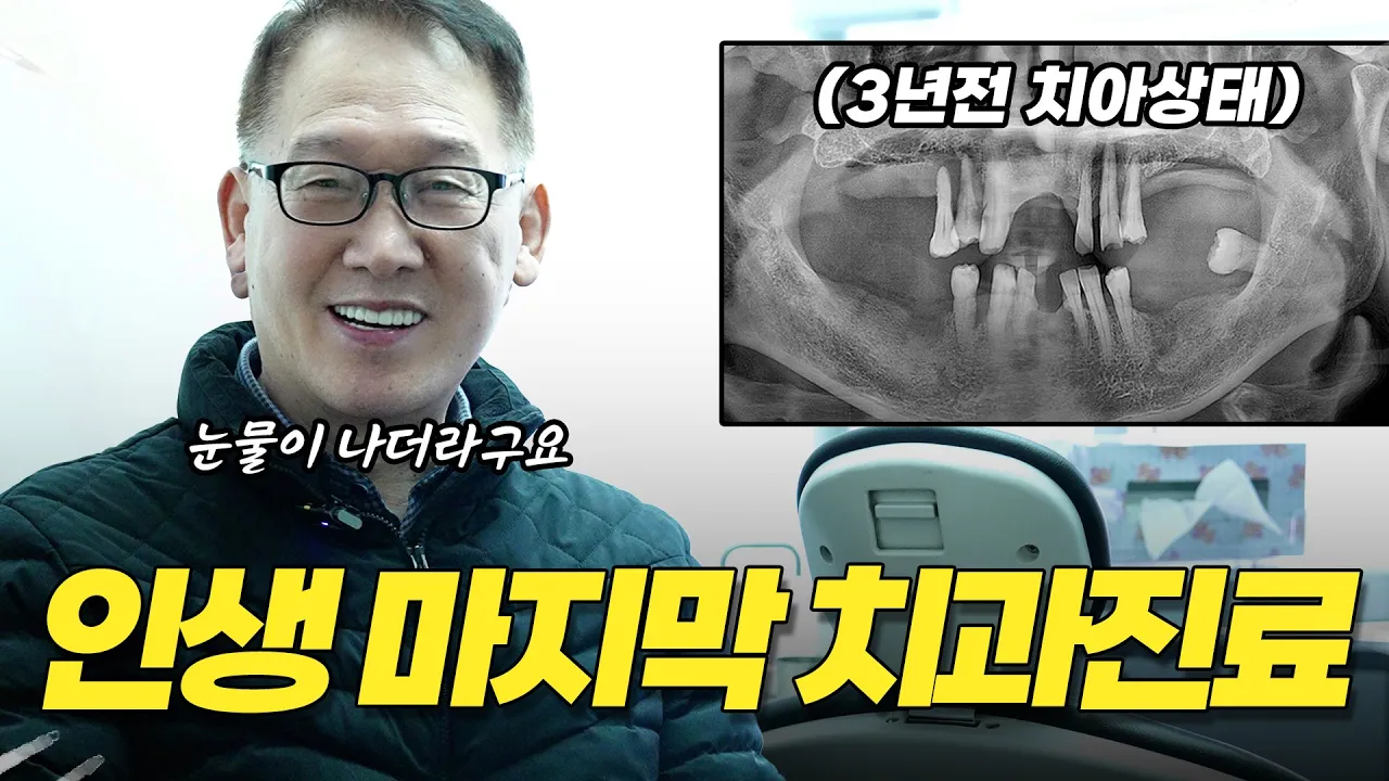 60대 마지막으로 선택한 치과치료.. 풀아치 임플란트 직접 3년간 사용해 보니...