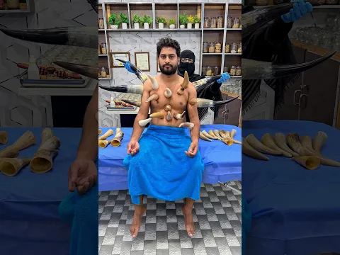 First Time Horn Cupping Therapy by Female Therapist in Pakistan | Herbalist Sunbal