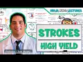 Ischemic and Hemorrhagic Strokes High Yield