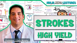 Ischemic and Hemorrhagic Strokes High Yield