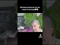 Nick Mercs Finds Out He Has A Headphone Dent On His Head