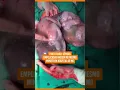 Download Lagu Parto raro: gêmeas empelicadas nascem no mesmo minuto em hospital de MG #uol #shorts