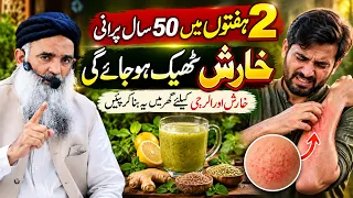 Alergy Ka elaj | Kharish Ka elaj | Itching Treatment at Home | Dr Sharafat Ali