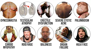 every steroid side effect explained what nobody shows you