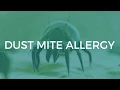 Lagu Dust Mite Allergy: Symptoms and Treatments