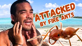 SEVERE ALLERGIC REACTION on a DESERTED ISLAND! –  (Episode 238)