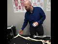 Dr Pichini explains the difference between radiculopathy vs sciatica Revitamax Rehab Rexdale Malton