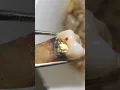 Download Lagu Gigi berlubang adalah salah satu faktor penyebab bau mulut 🤢 jangan sampai pas lebaran malah jadi