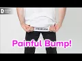 Painful bump on buttocks Causes Symptoms Treatment - Dr Rajdeep Mysore Doctors Circle