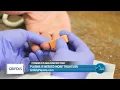 Why You Should Donate Plasma Grifols