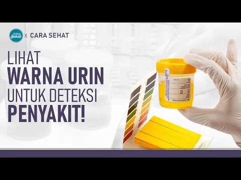 Cara Mendeteksi Penyakit Dilihat Dari Warna Urin