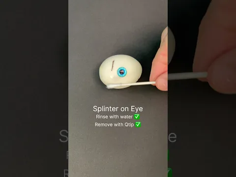 Bug in your eye? Just try this…