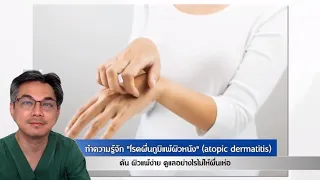 โรคภูมิแพ้ผิวหนังเกิดจากสาเหตุหลักอะไร และมีลักษณะทางพันธุกรรมอย่างไร