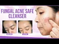 5 Best Fungal Acne Safe Cleansers Face Washes Recommended By Experts