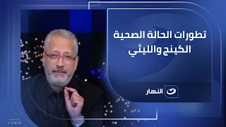 الفنان مصطفى كامل يكشف أخر المستجدات والحالة الصحية للفنان محمد منير والمطرب الشعبي اسماعيل الليثي 