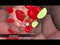 How Your Body Heals Cuts, Scrapes, and Puncture Wounds to the Skin