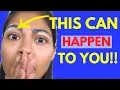 How I Get Rid Of Eyebrow Dandruff Fast
