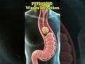 How the Esophagus Works Peristaltic Waves in Action