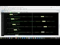 Ejericicio Practico en Java usando Clases JOptionPane DecimalFormat