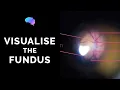 Fundoscopy How to Visualise the Fundus Direct Ophthalmoscopy OSCE Guide UKMLA CPSA