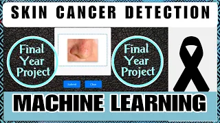Skin Cancer Detection Using Machine Learning Python Projects Finalyear Projects Bme Project