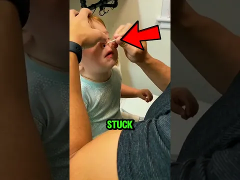 What Was Stuck Inside This Boyβs Nose? π³