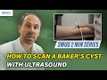Lagu Hoe een Bakerse cyste te scannen met echografie | MSK Knie-echografie tutorial voor clinici