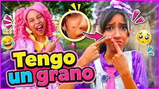 Ángela TIENE un GRANO| ÁNGELA no quiere SALIR| franchesca y sus amigos 