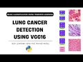Lung Cancer Detection using VGG16 Image Classification using Transfer Learning
