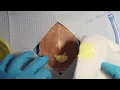 Incision and Drainage of Cutaneous Abscesses