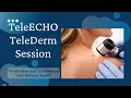 TeleECHO TeleDerm Session 34 - Evaluation and treatment of itch without rash