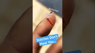 الغرز لا تشفي جروحك    دندنها