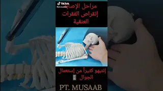 مشاكل في الفقرات العنق لمستعملي الجوال الام الرأس والدوخة قلة النوم 