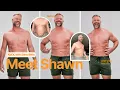 Hear Shawn s full Sono Bello liposuction story