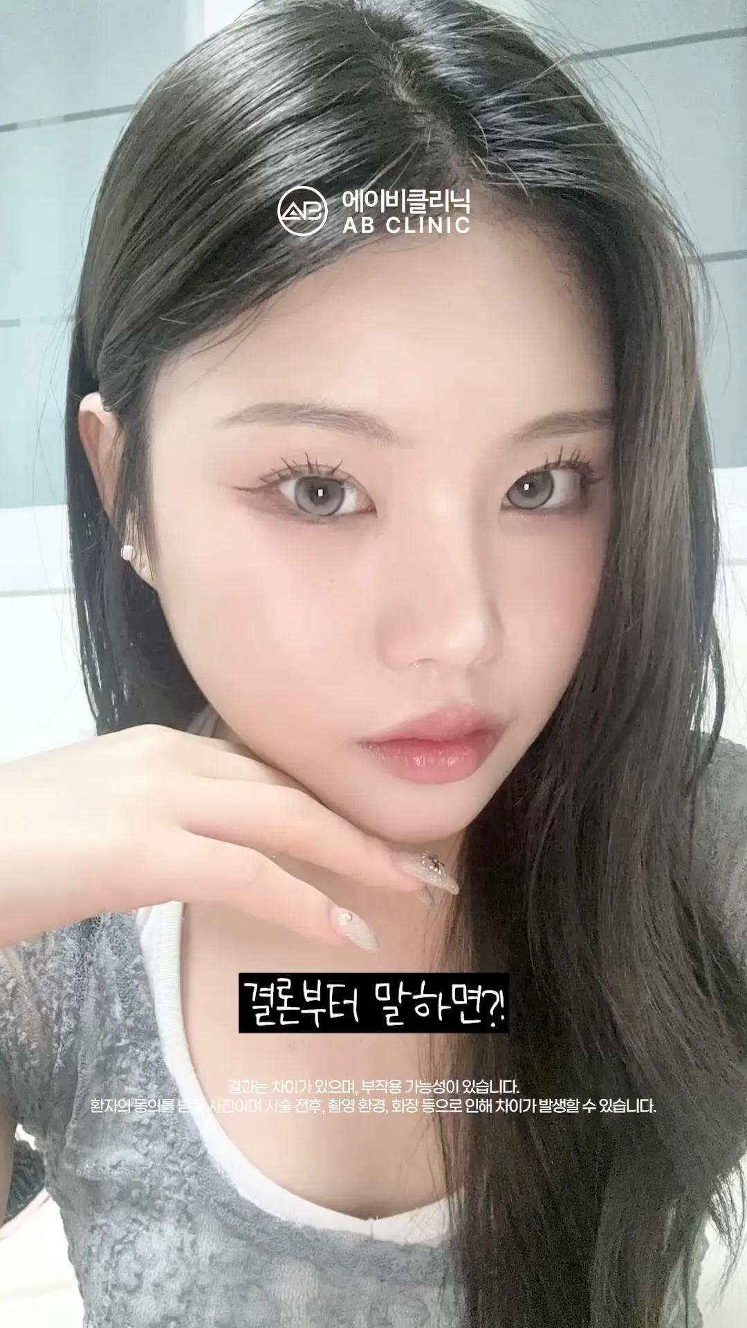 겨울철 피부재생 no.1 시술 낋여옴💧