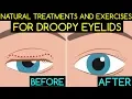 Download Lagu Natural Treatments and Exercises For Droopy Eyelids
