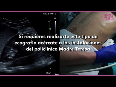 Download MP3 Ecografía renal y vías urinarias